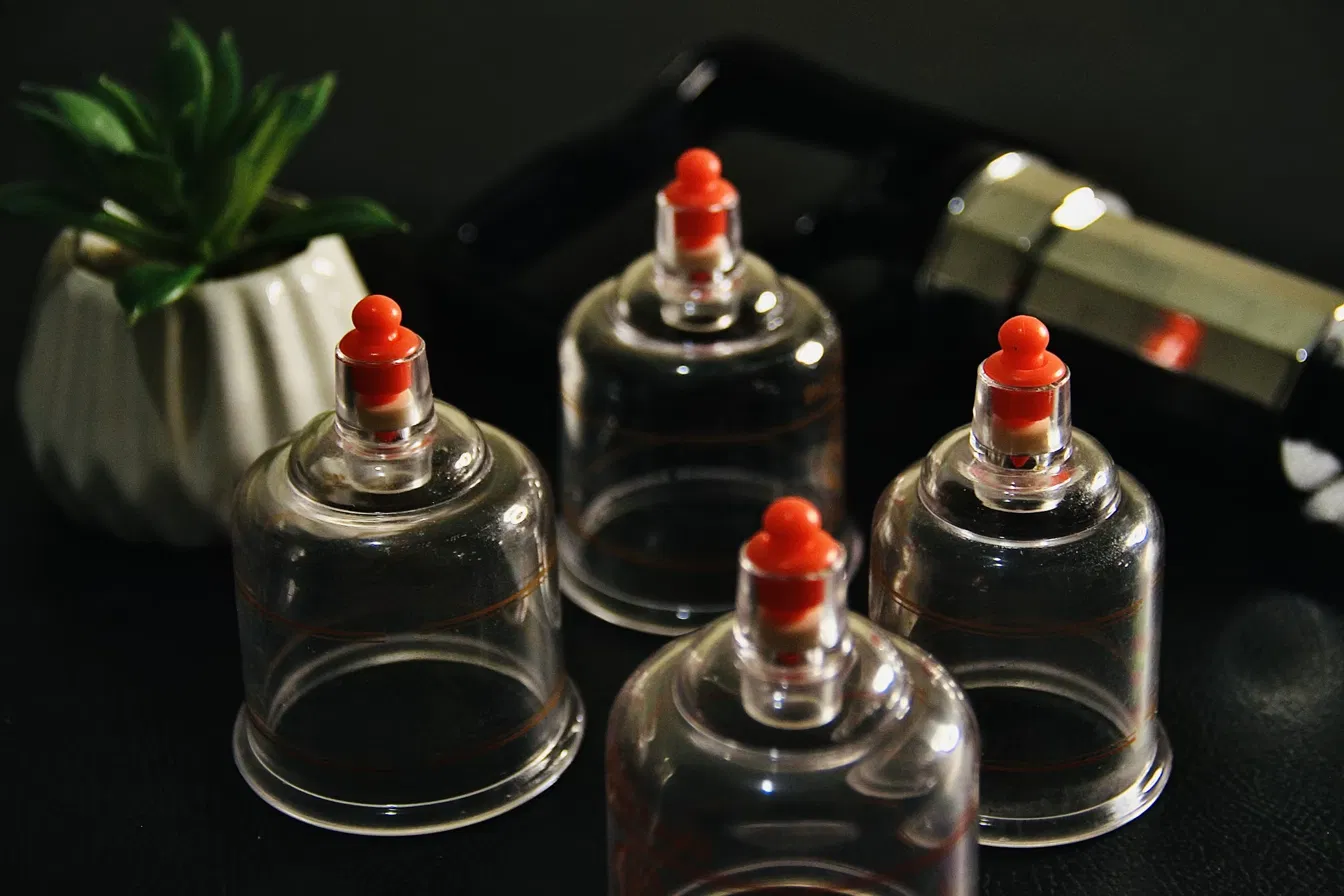 Ventouses de hijama, thérapie de la médecine prophétique